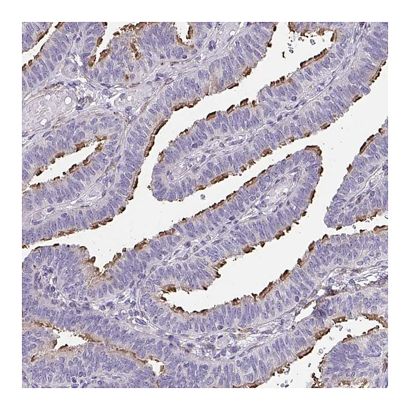 Atlas Antibodies Anti-RUNDC3B Antibody