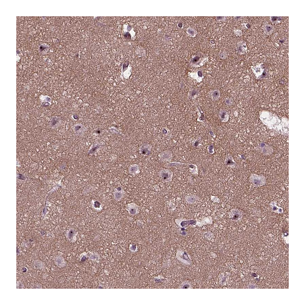 Atlas Antibodies Anti-RUNX1T1 Antibody