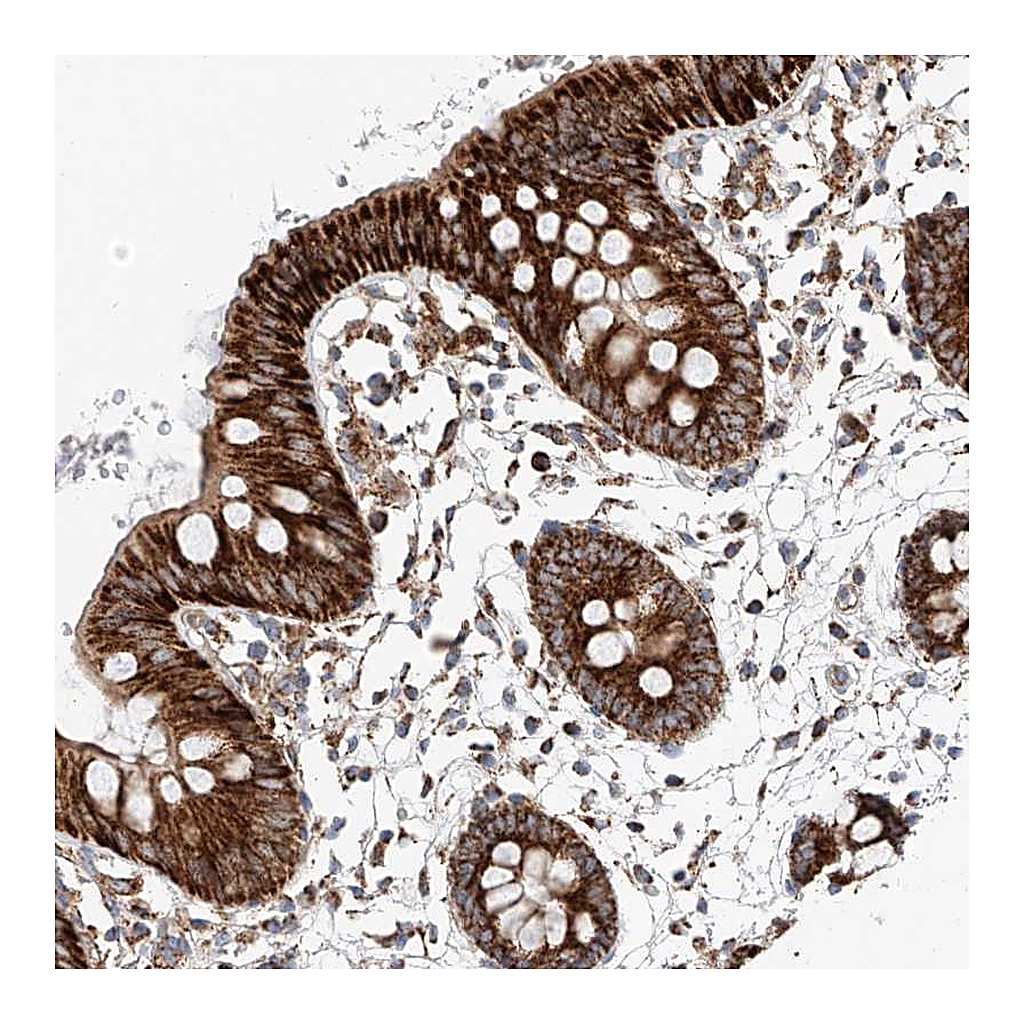 Atlas Antibodies Anti-RUSC1 Antibody