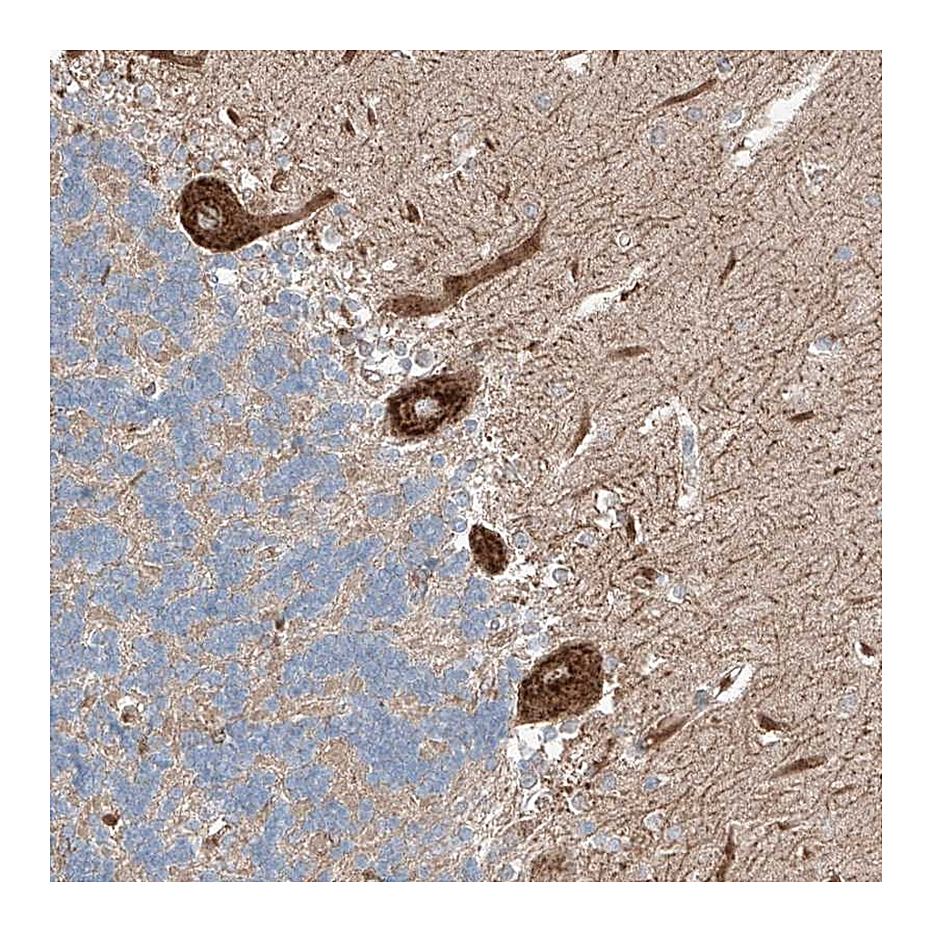Atlas Antibodies Anti-RUSC1 Antibody