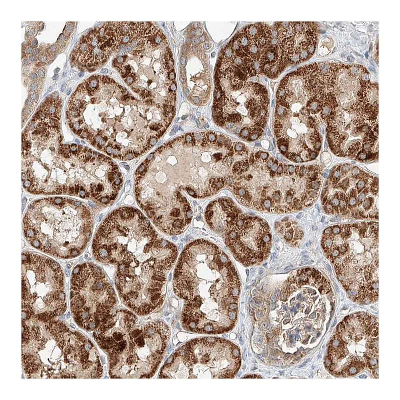 Atlas Antibodies Anti-RUSC1 Antibody