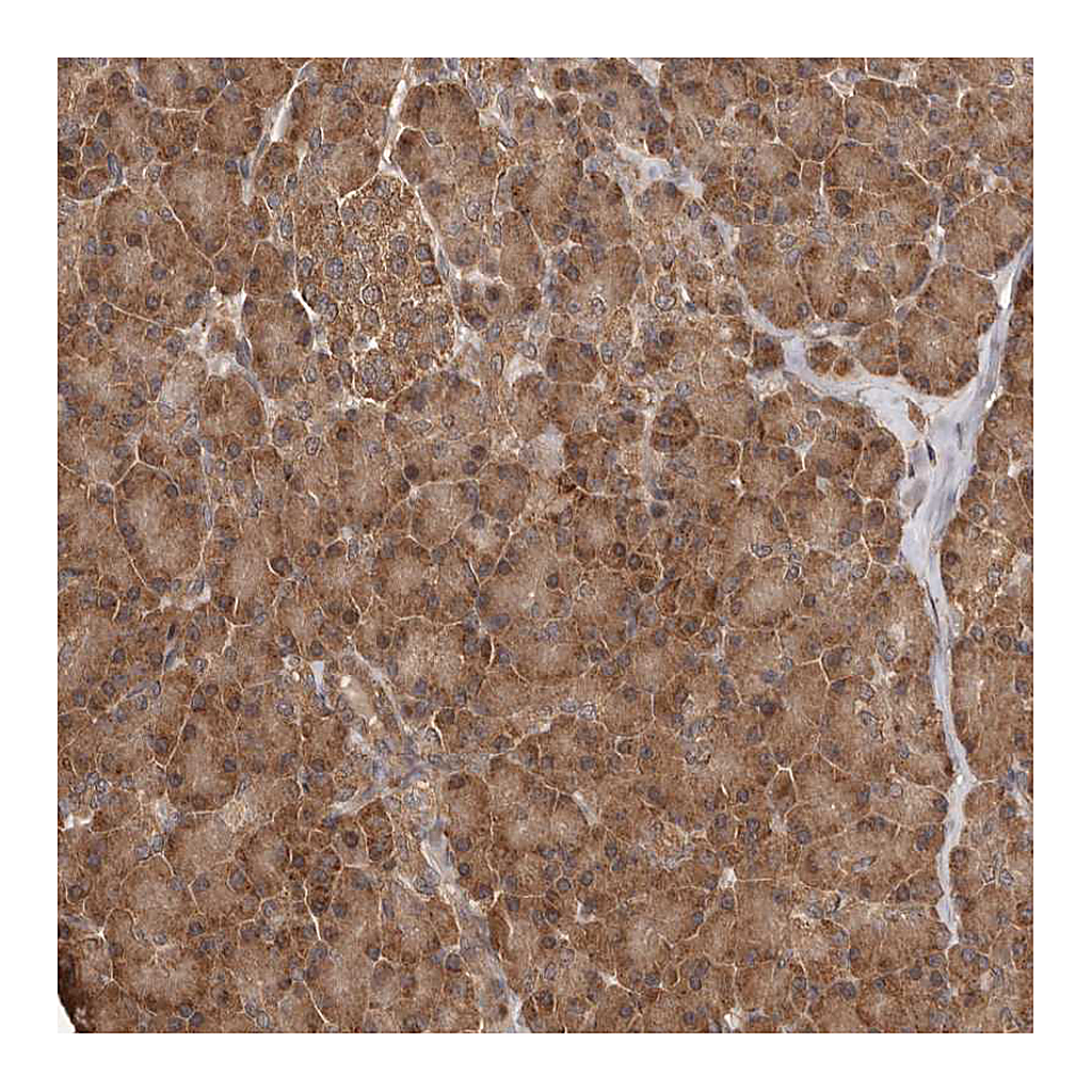 Atlas Antibodies Anti-RWDD1 Antibody