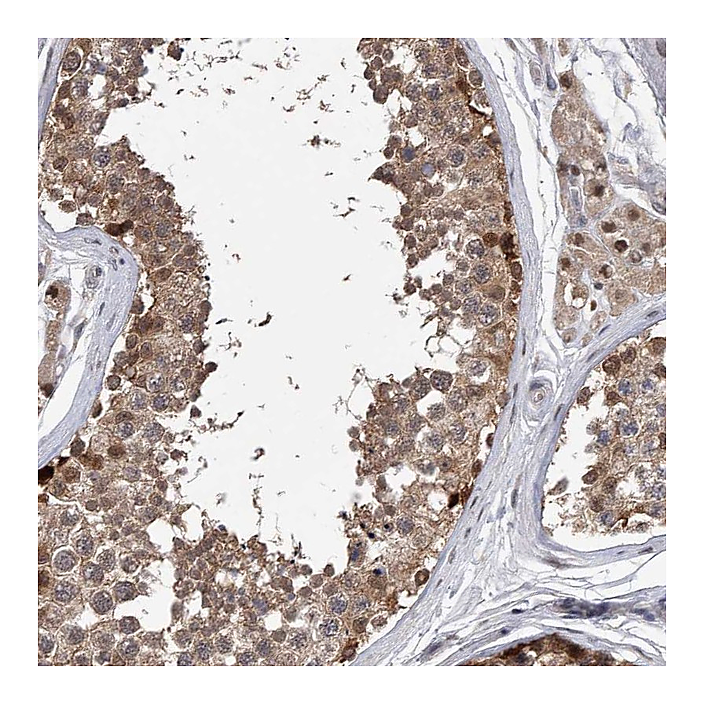 Atlas Antibodies Anti-RWDD2A Antibody