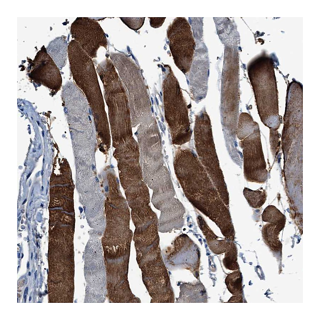 Atlas Antibodies Anti-RWDD2B Antibody