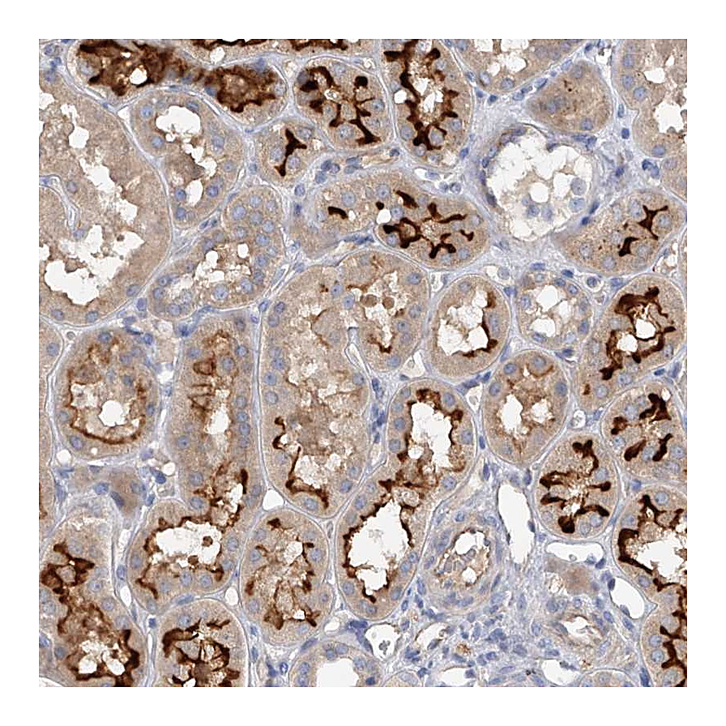 Atlas Antibodies Anti-RWDD2A Antibody