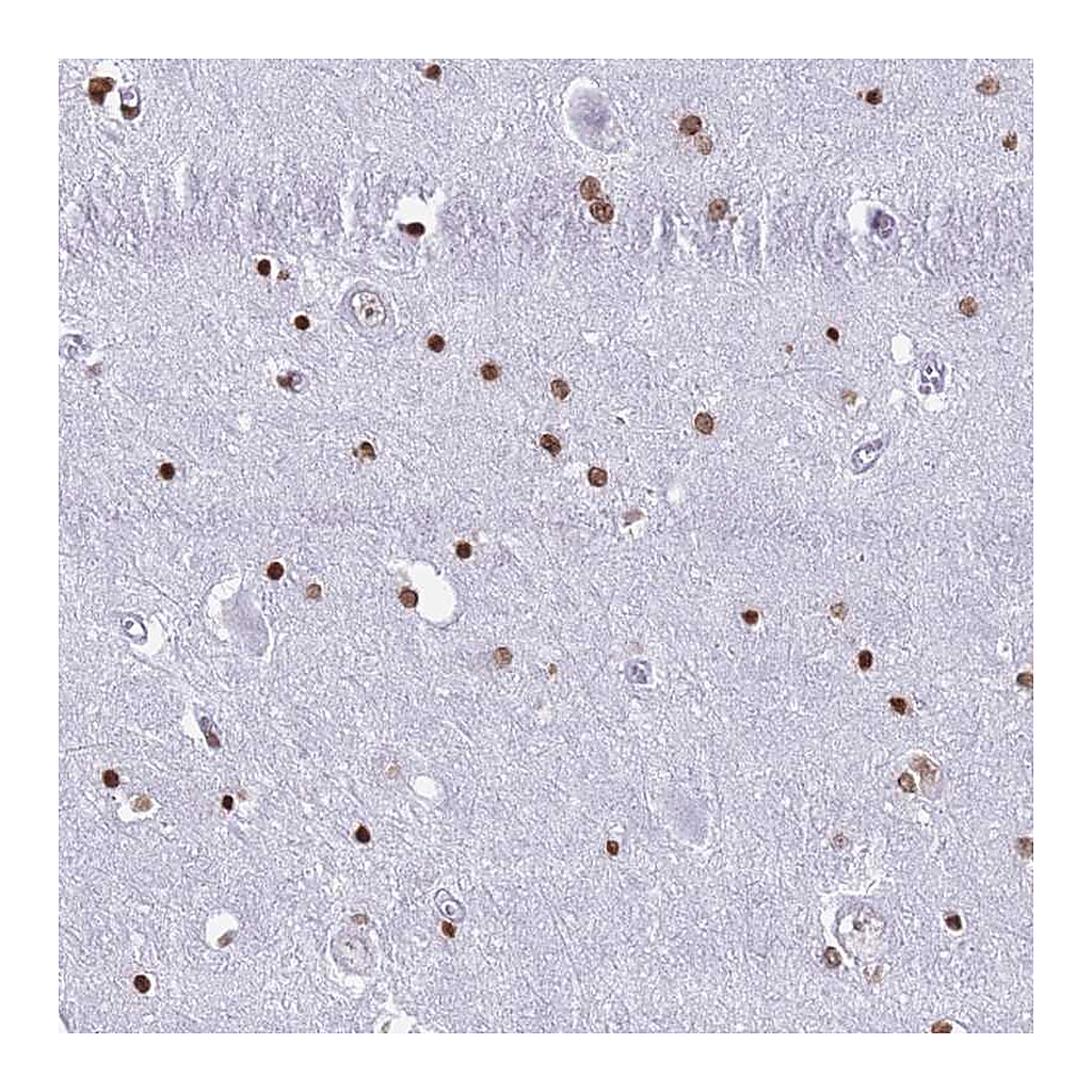 Atlas Antibodies Anti-RYK Antibody