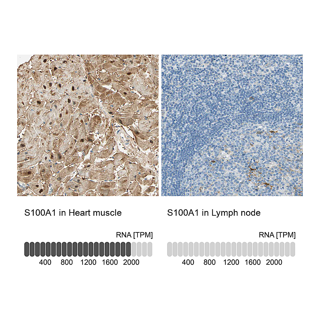 Atlas Antibodies Anti-S100A1 Antibody