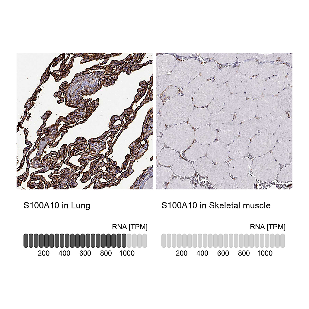 Atlas Antibodies Anti-S100A10 Antibody