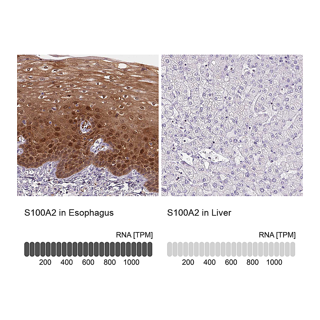 Atlas Antibodies Anti-S100A2 Antibody