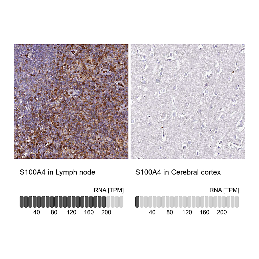 Atlas Antibodies Anti-S100A4 Antibody