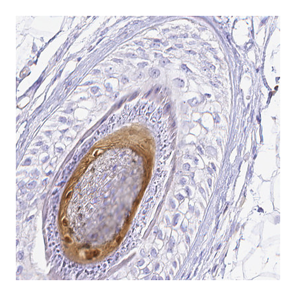 Atlas Antibodies Anti-S100A3 Antibody