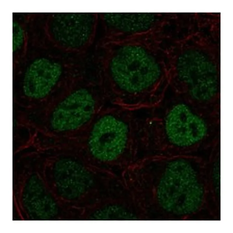 Atlas Antibodies Anti-S100P Antibody