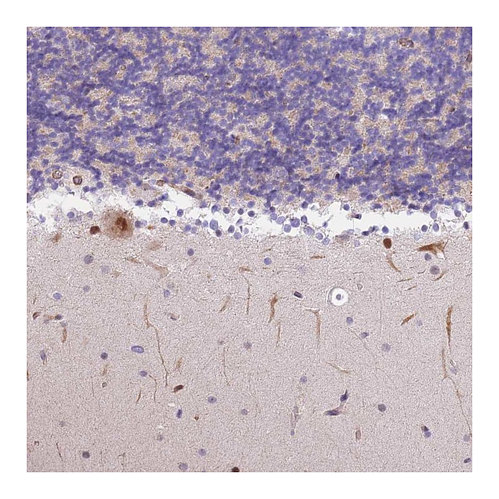 Atlas Antibodies Anti-S100PBP Antibody