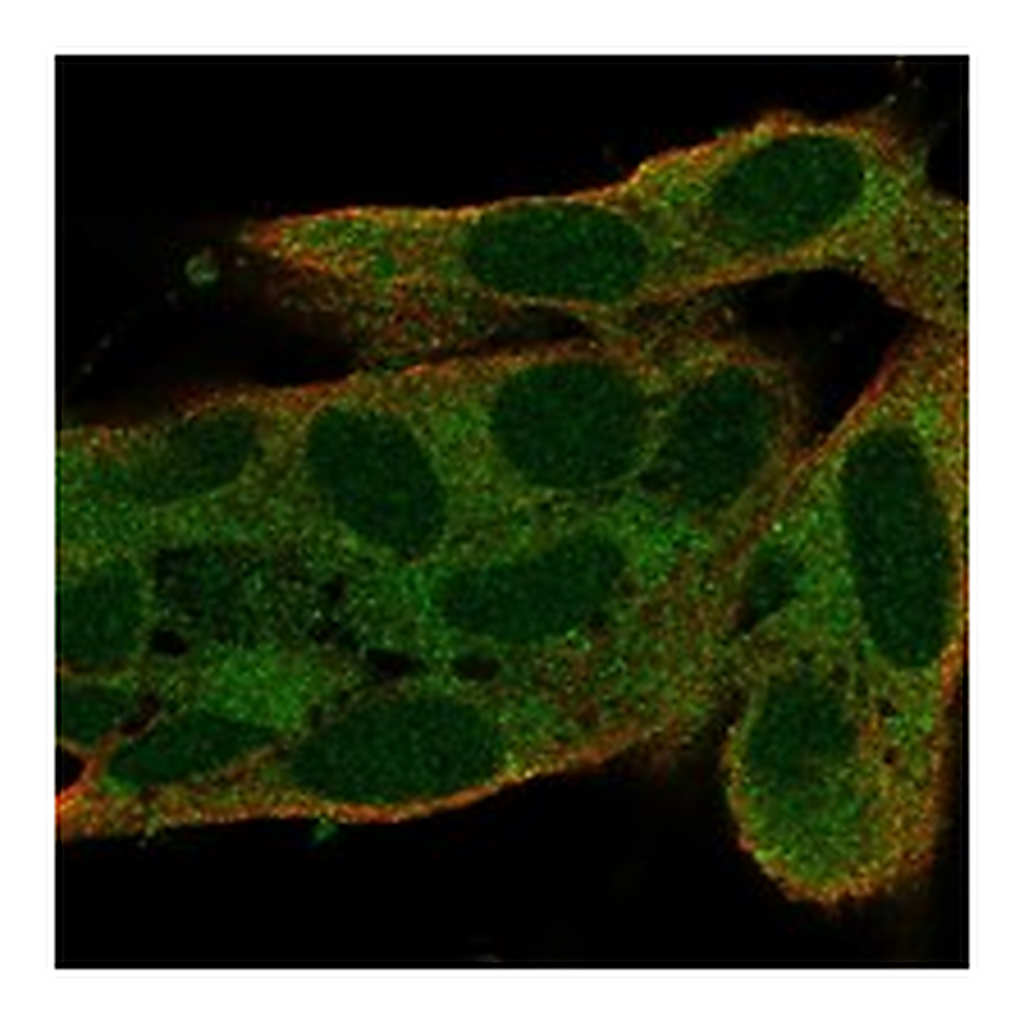 Atlas Antibodies Anti-S100G Antibody