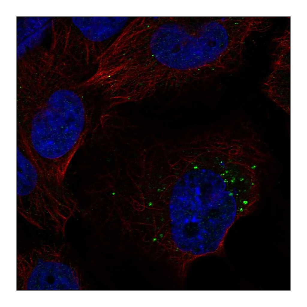 Atlas Antibodies Anti-S1PR1 Antibody