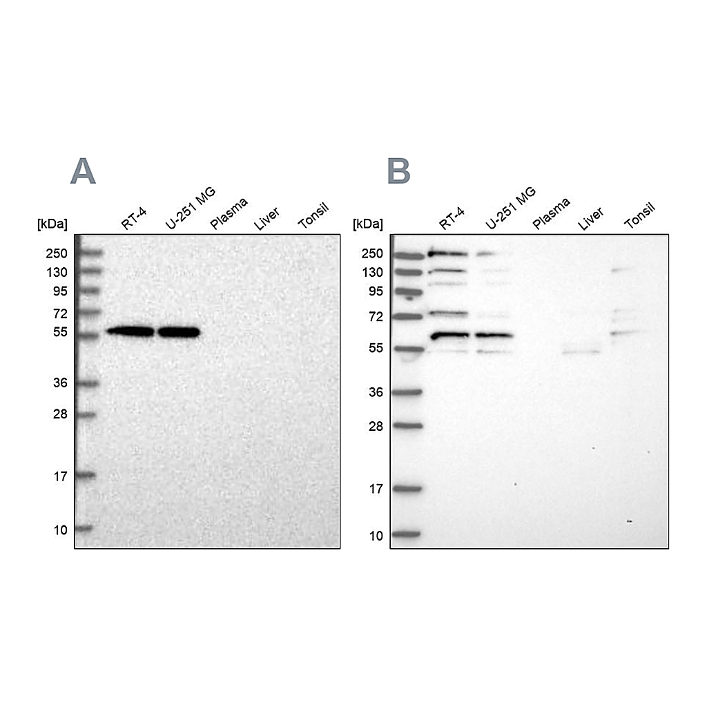 Atlas Antibodies Anti-SAAL1 Antibody