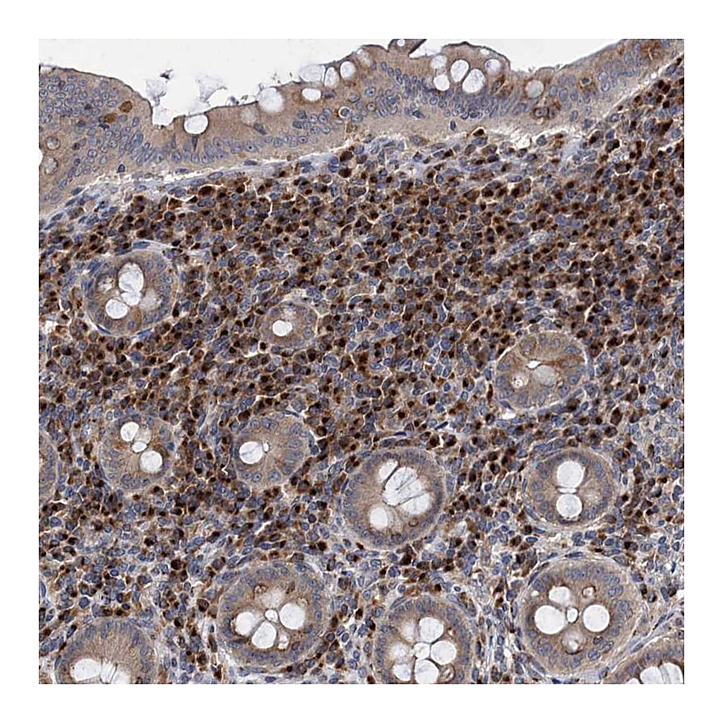 Atlas Antibodies Anti-SAAL1 Antibody