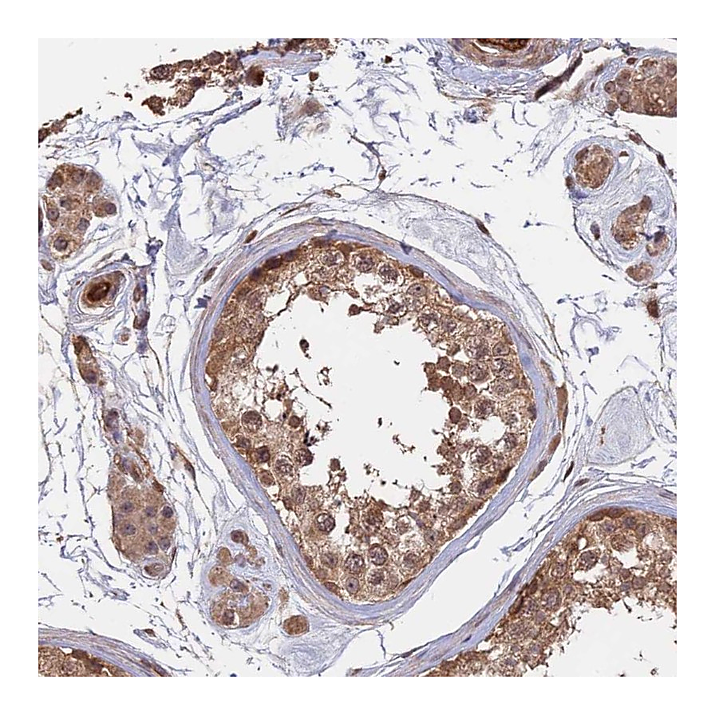 Atlas Antibodies Anti-SAC3D1 Antibody