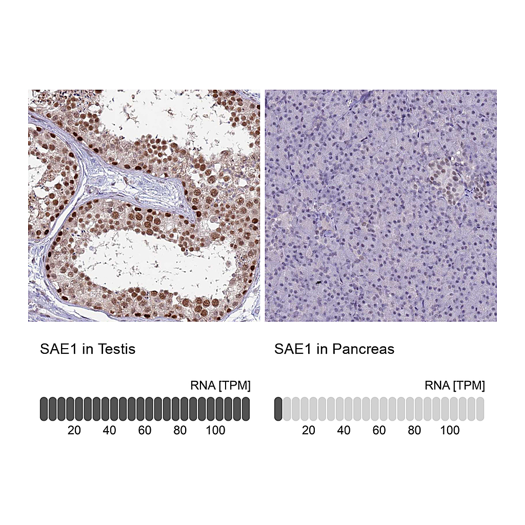 Atlas Antibodies Anti-SAE1 Antibody