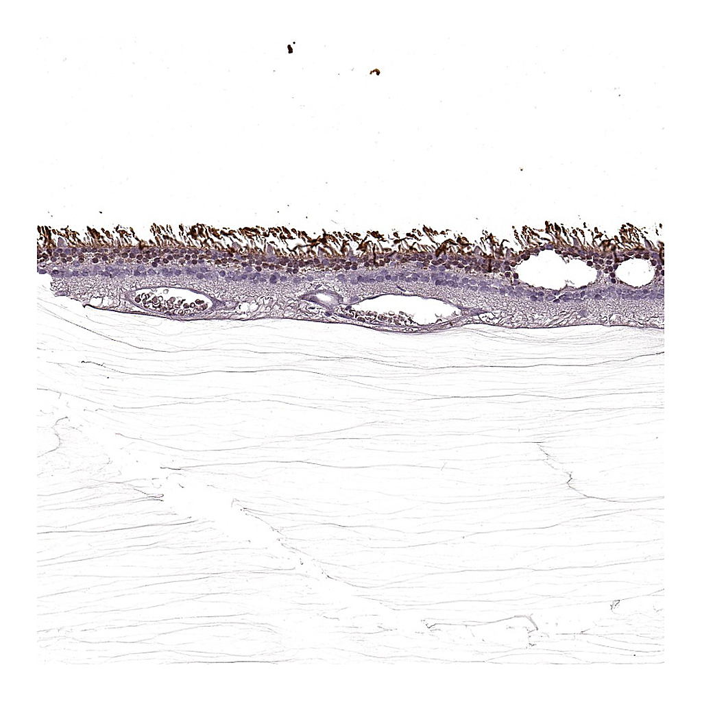 Atlas Antibodies Anti-SAG Antibody