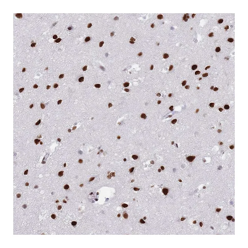 Atlas Antibodies Anti-SAFB2 Antibody