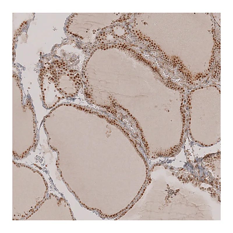 Atlas Antibodies Anti-SALL1 Antibody