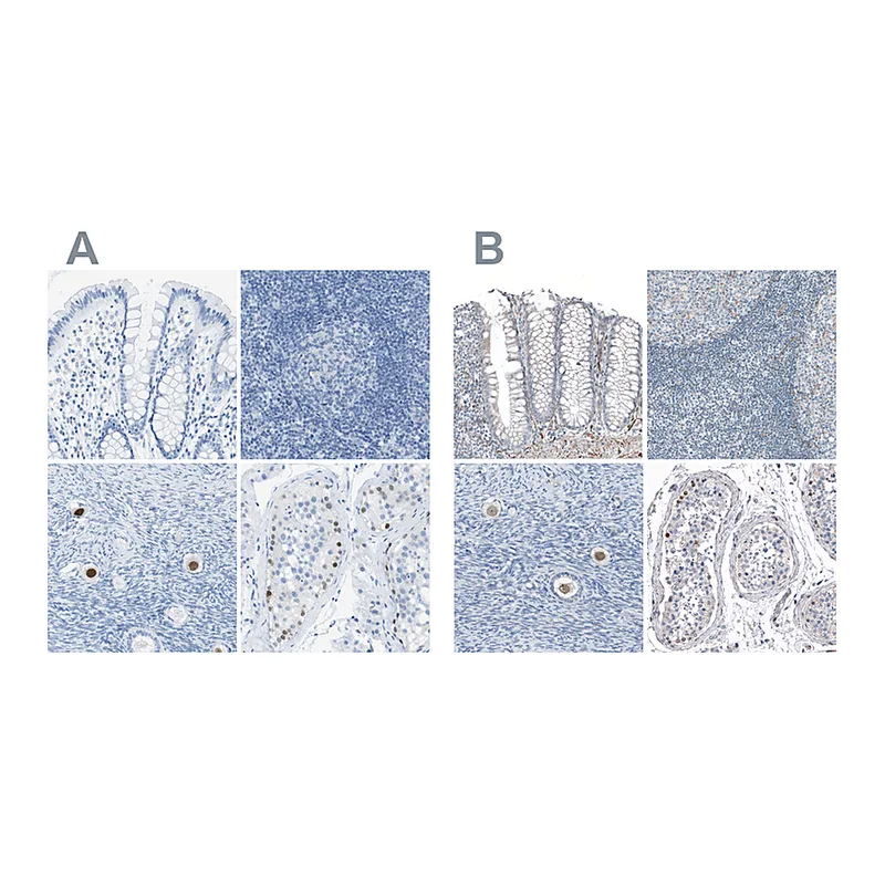 Atlas Antibodies Anti-SALL4 Antibody