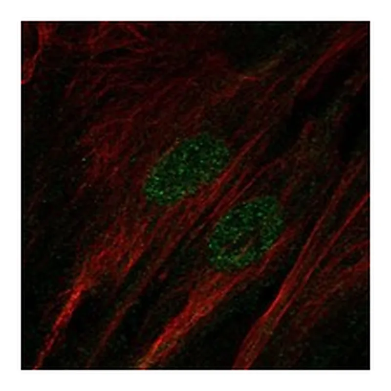 Atlas Antibodies Anti-SALL1 Antibody