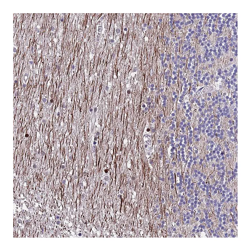 Atlas Antibodies Anti-SAMD1 Antibody
