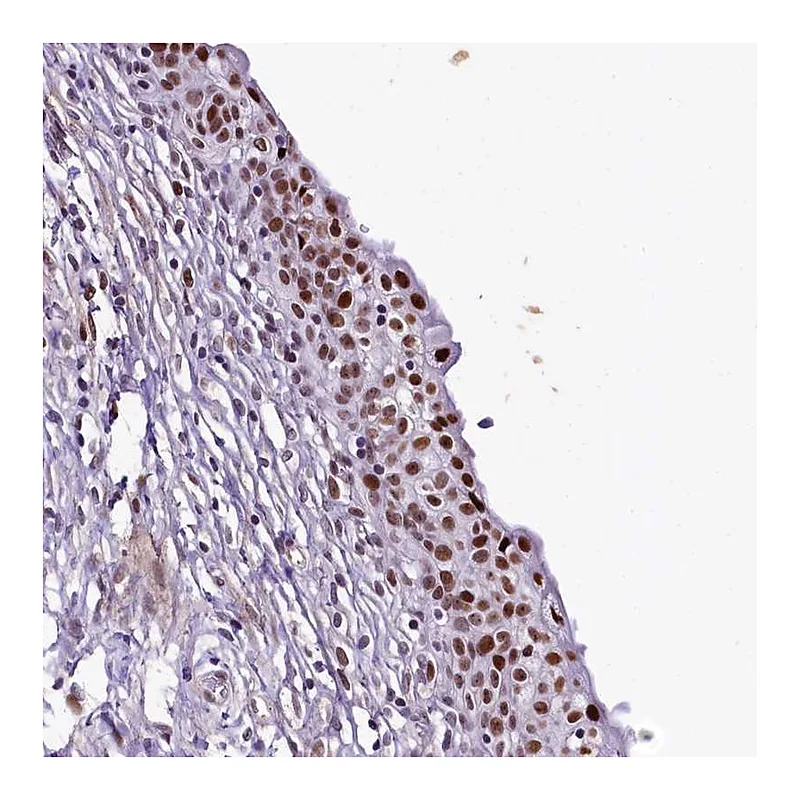 Atlas Antibodies Anti-SAMD10 Antibody