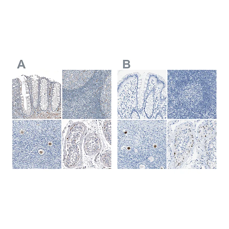 Atlas Antibodies Anti-SALL4 Antibody