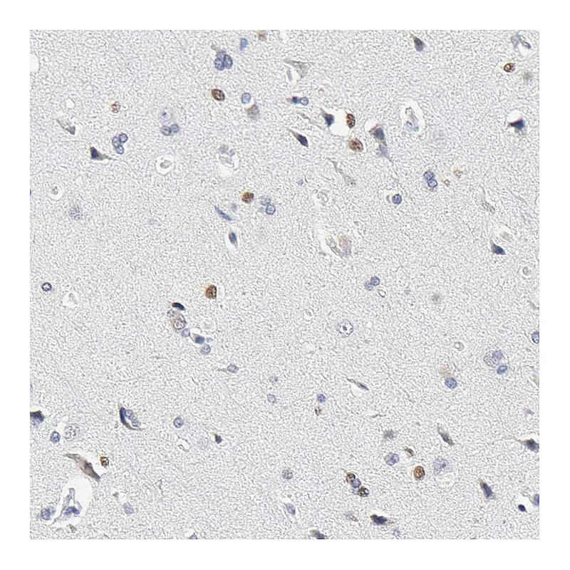 Atlas Antibodies Anti-SALL2 Antibody