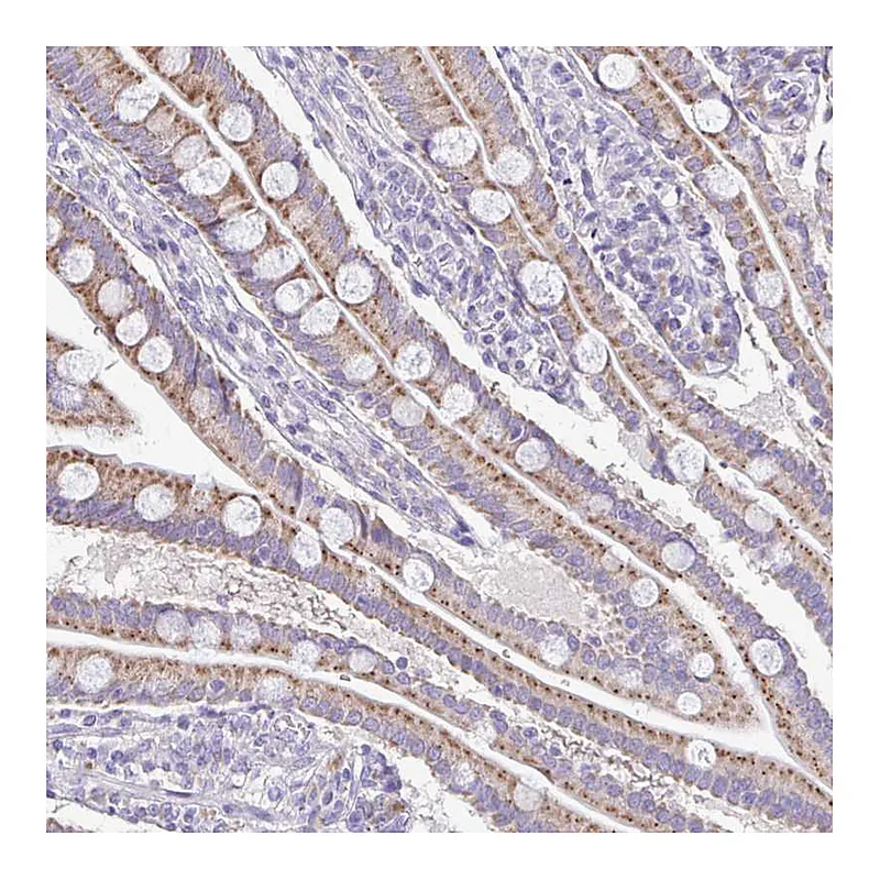 Atlas Antibodies Anti-SAMD13 Antibody