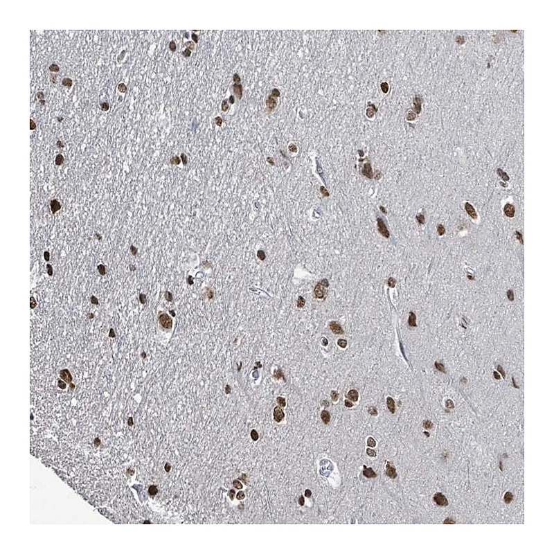 Atlas Antibodies Anti-SAMD14 Antibody