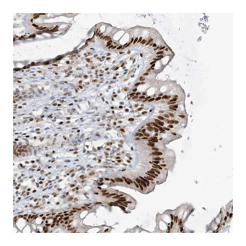 Atlas Antibodies Anti-SAMD15 Antibody
