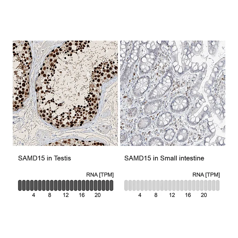 Atlas Antibodies Anti-SAMD15 Antibody