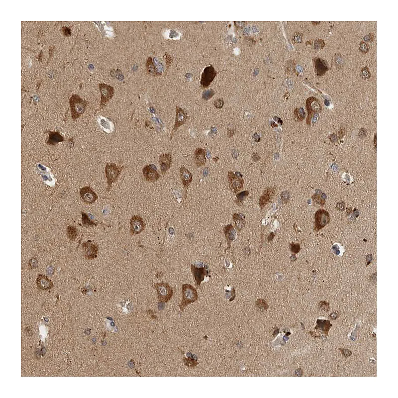 Atlas Antibodies Anti-SAMD12 Antibody
