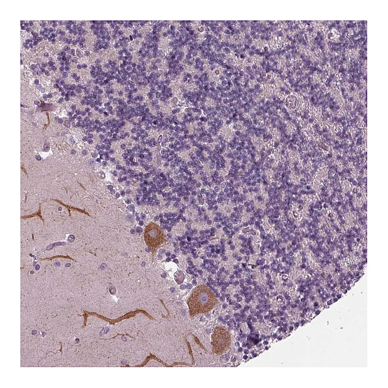 Atlas Antibodies Anti-SAMD4A Antibody