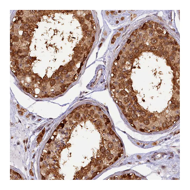 Atlas Antibodies Anti-SAMD4A Antibody