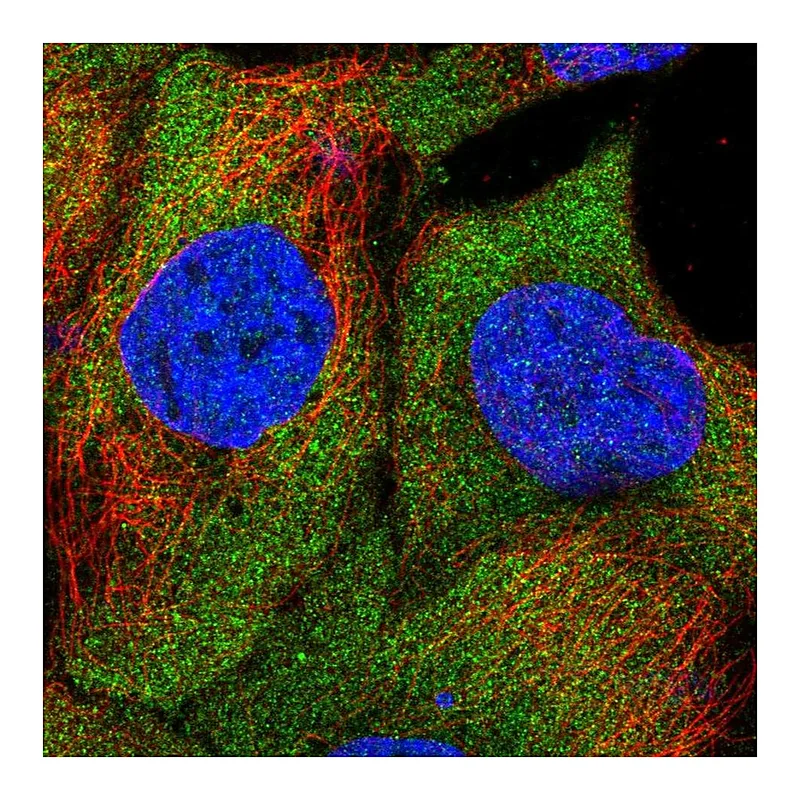 Atlas Antibodies Anti-SAMD4B Antibody