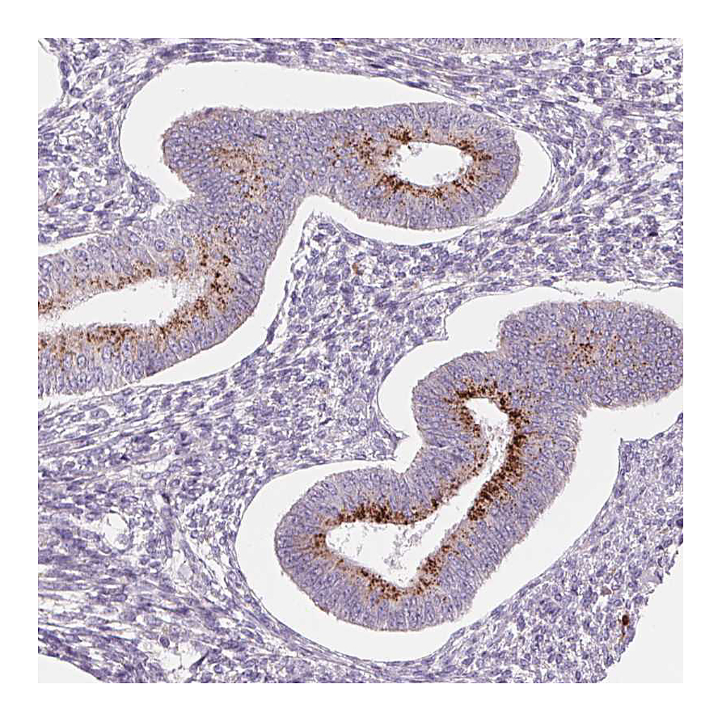 Atlas Antibodies Anti-SAMD5 Antibody