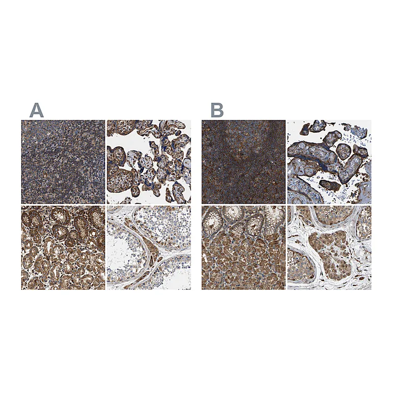 Atlas Antibodies Anti-SAMD9L Antibody