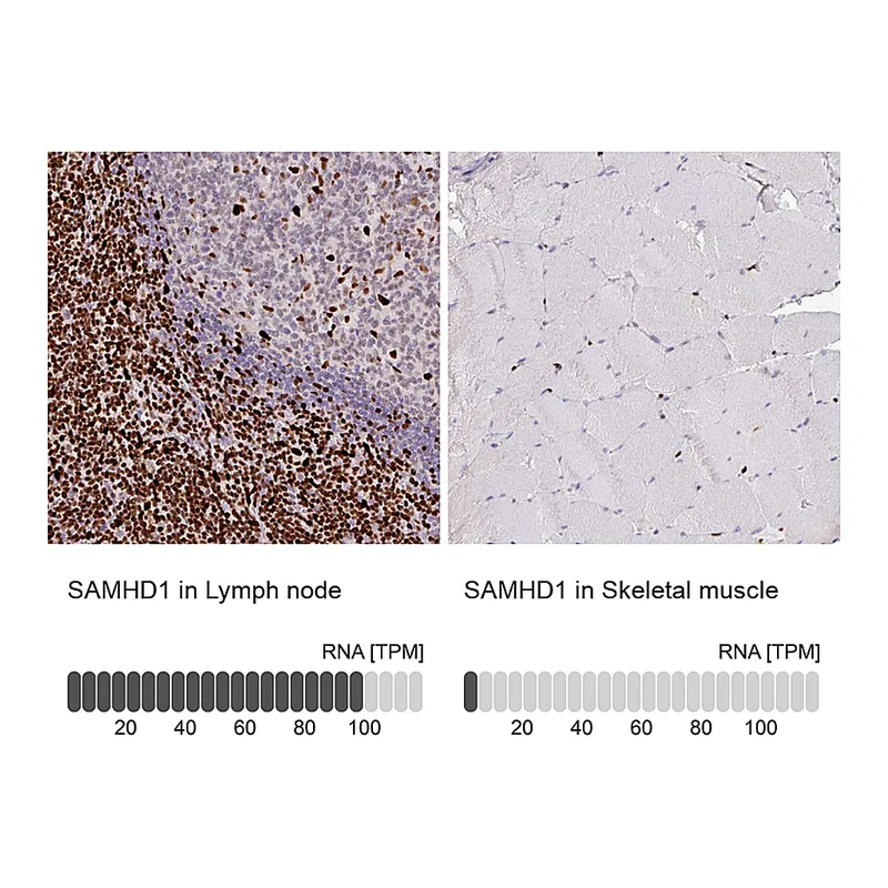 Atlas Antibodies Anti-SAMHD1 Antibody