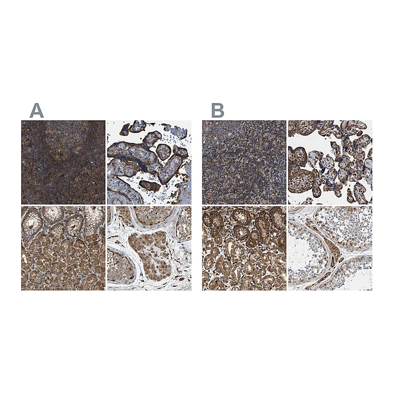 Atlas Antibodies Anti-SAMD9L Antibody