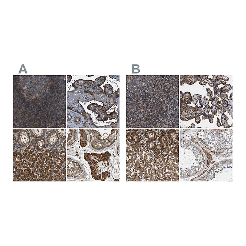 Atlas Antibodies Anti-SAMD9L Antibody