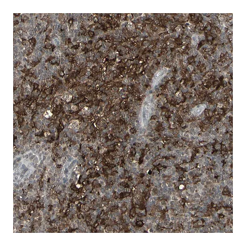 Atlas Antibodies Anti-SAMSN1 Antibody