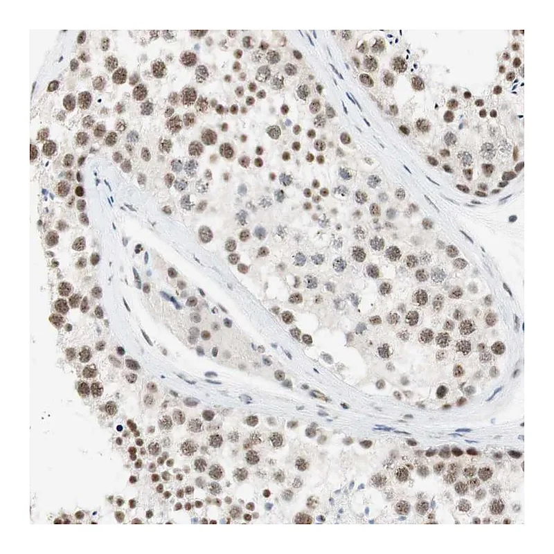 Atlas Antibodies Anti-SAP18 Antibody