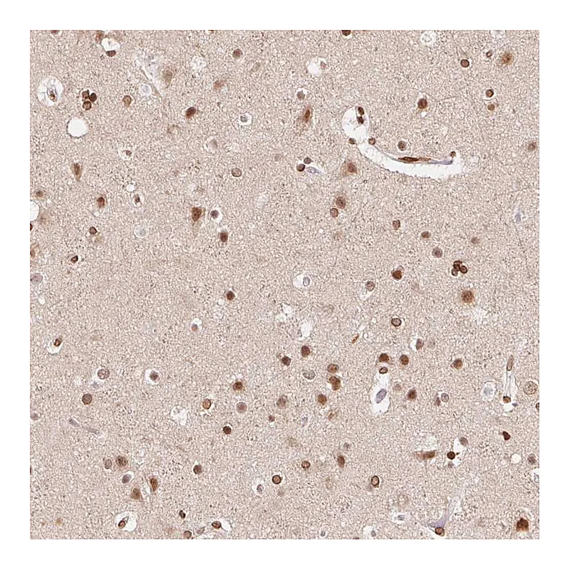 Atlas Antibodies Anti-SAP30BP Antibody