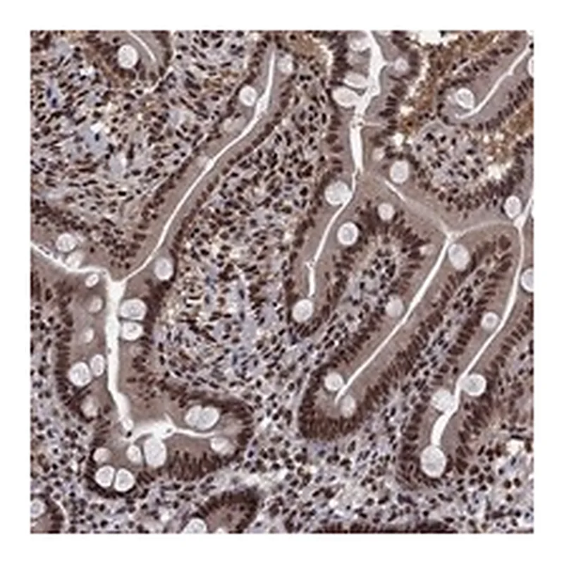 Atlas Antibodies Anti-SAP30L Antibody