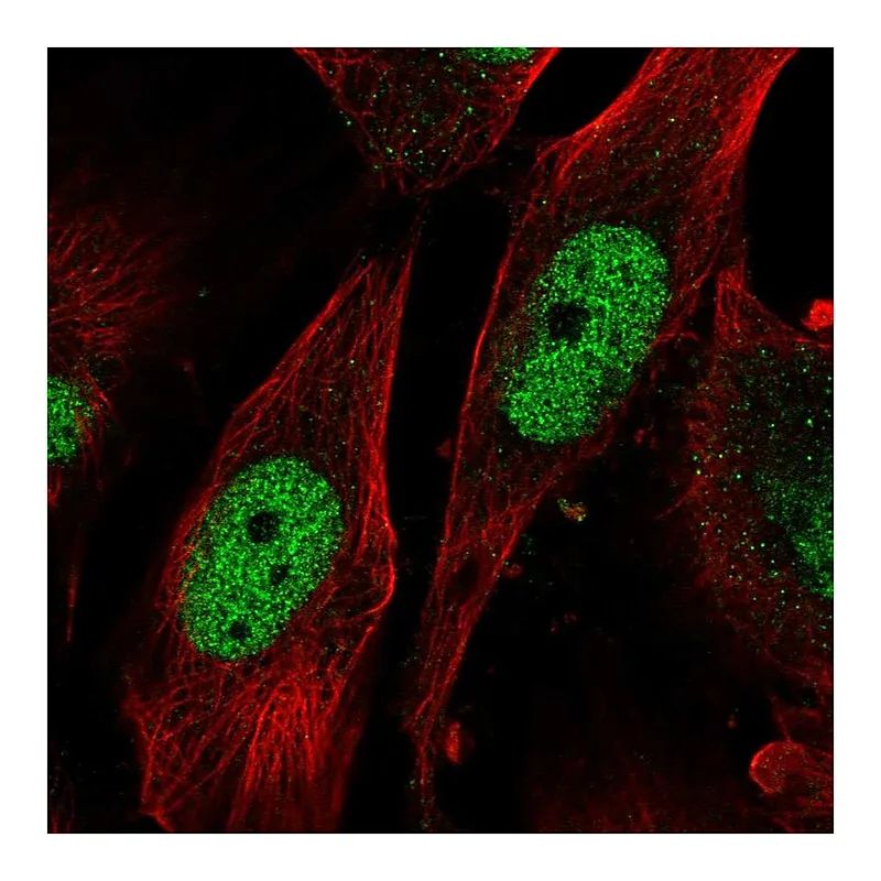 Atlas Antibodies Anti-SAP30 Antibody